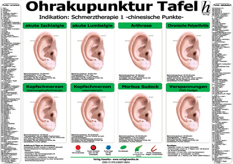 Ohrakupunktur Tafel - Indikation: Schmerztherapie 1 - 