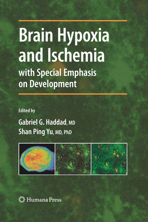 Brain Hypoxia and Ischemia - 