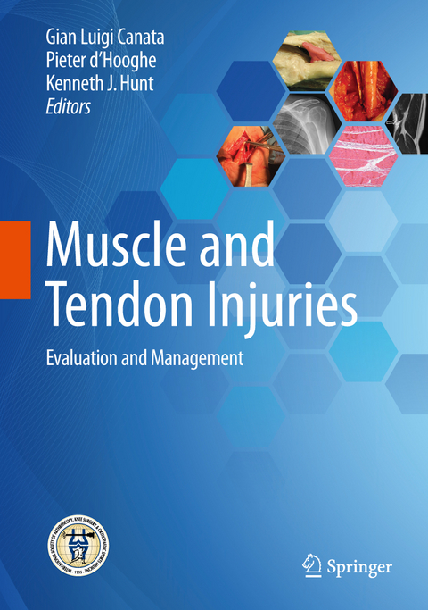 Muscle and Tendon Injuries - 