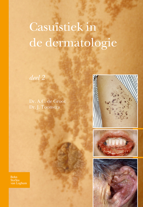 Casu�stiek in de Dermatologie - Deel 2 - Johan Toonstra