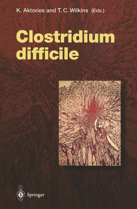 Clostridium difficile - 