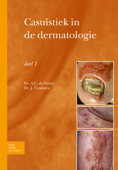 Casu�stiek in de Dermatologie - Deel I - Anton C Groot, Johan Toonstra