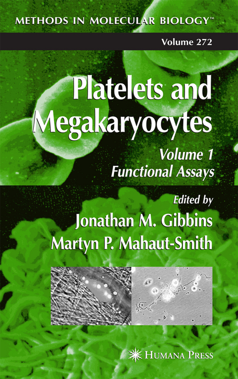 Platelets and Megakaryocytes - 