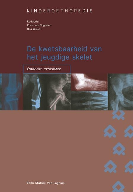 de Kwetsbaarheid Van Het Jeugdige Skelet: Onderste Extremiteit - J Van Nugteren, F D Winkel