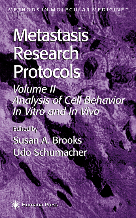 Metastasis Research Protocols - 