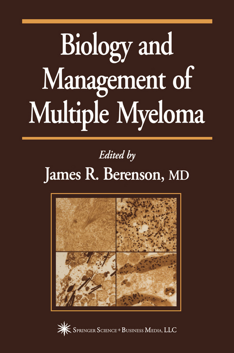 Biology and Management of Multiple Myeloma - 