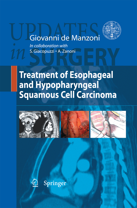 Treatment of Esophageal and Hypopharingeal Squamous Cell Carcinoma - 