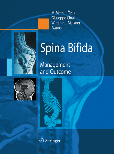 Spina Bifida - 