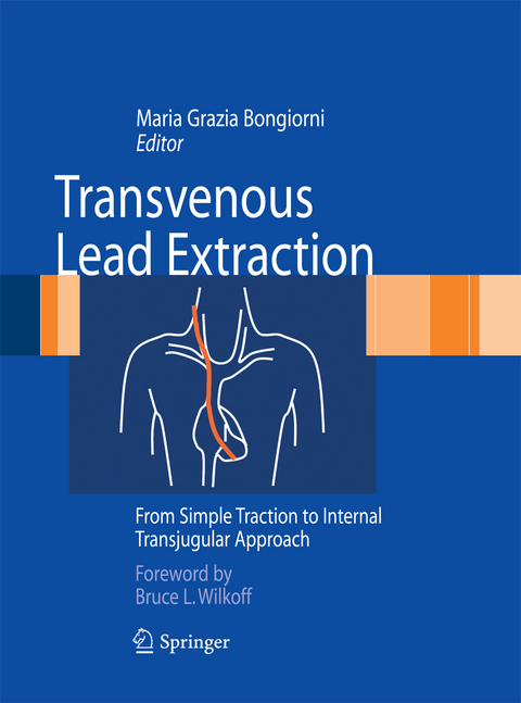 Transvenous Lead Extraction - 