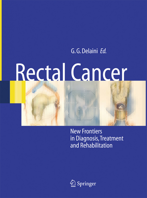 Rectal Cancer - 