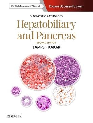 Diagnostic Pathology: Hepatobiliary and Pancreas - Laura Webb Lamps, Sanjay Kakar