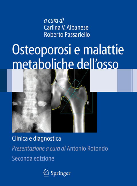 Osteoporosi e malattie metaboliche dell'osso - 