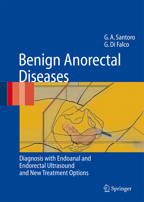 Benign Anorectal Diseases - Giulio Aniello Santoro, Giuseppe Di Falco