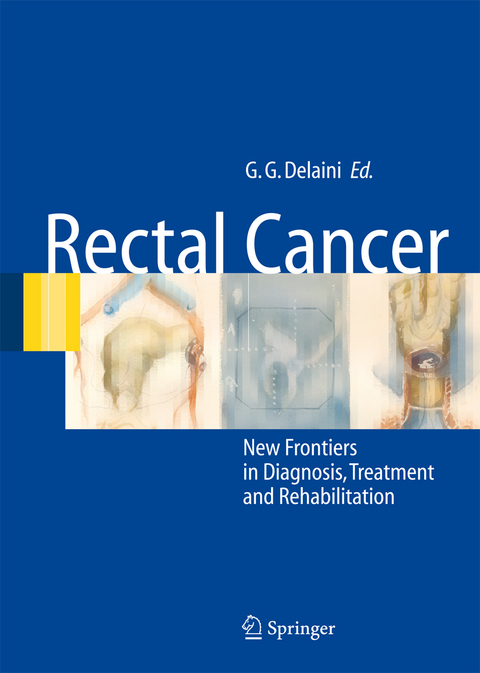 Rectal Cancer - 