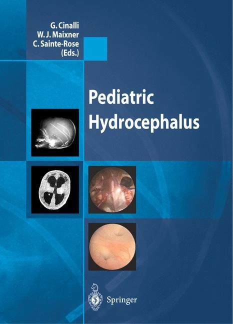 Pediatric Hydrocephalus - 