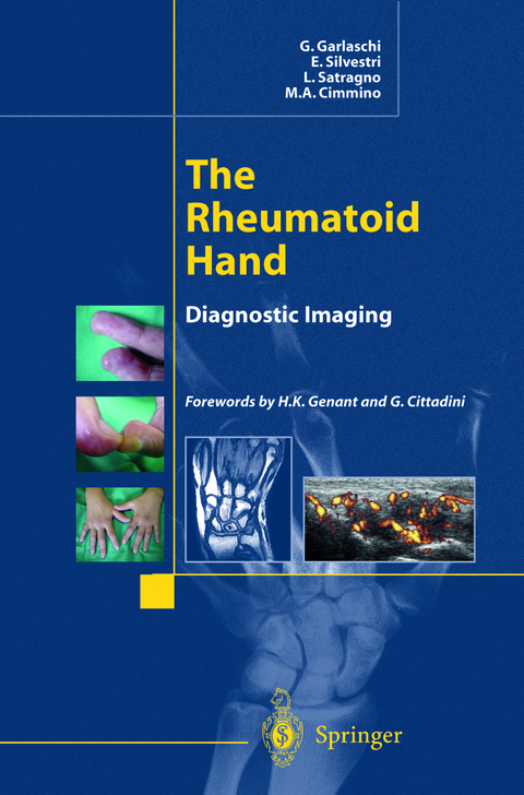 The Rheumatoid Hand - G. Garlaschi, E. Silvestri, L. Satragno