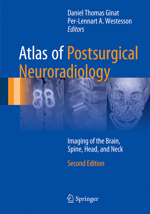 Atlas of Postsurgical Neuroradiology - 