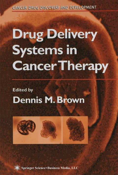 Drug Delivery Systems in Cancer Therapy - 