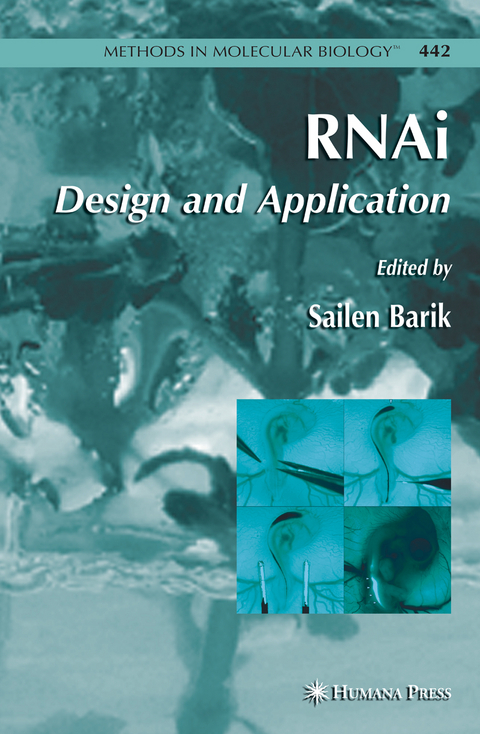 RNAi - 