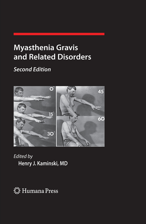 Myasthenia Gravis and Related Disorders - 