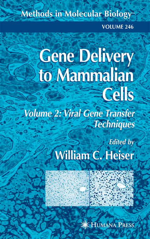 Gene Delivery to Mammalian Cells - 