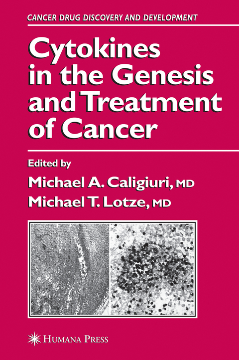 Cytokines in the Genesis and Treatment of Cancer - 