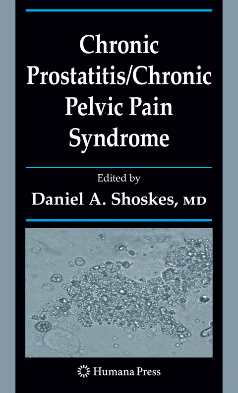 Chronic Prostatitis/Chronic Pelvic Pain Syndrome - 