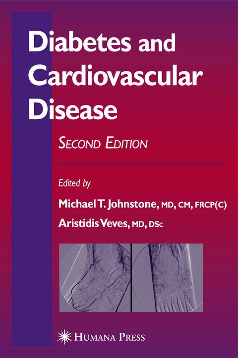 Diabetes and Cardiovascular Disease - 