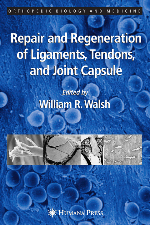 Repair and Regeneration of Ligaments, Tendons, and Joint Capsule - 