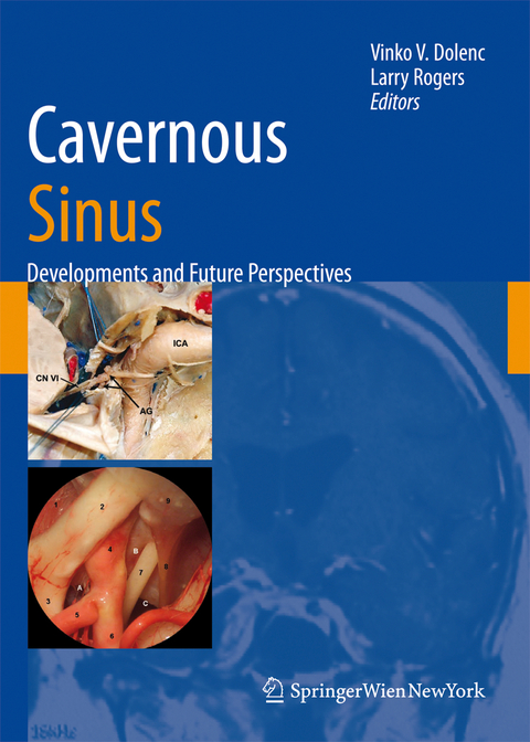 Cavernous Sinus - 