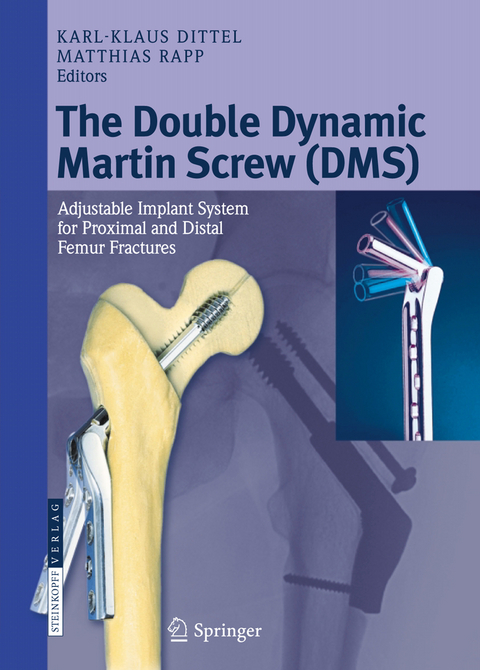 The Double Dynamic Martin Screw (DMS) - 