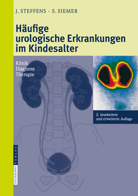 Häufige urologische Erkrankungen im Kindesalter - Joachim Steffens, Stefan Siemer