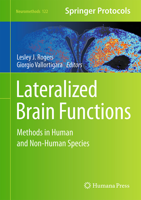 Lateralized Brain Functions - 