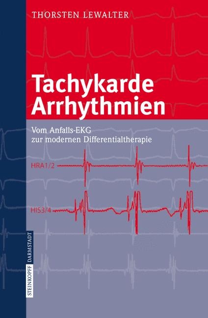 Tachykarde Arrhythmien - Thorsten Lewalter