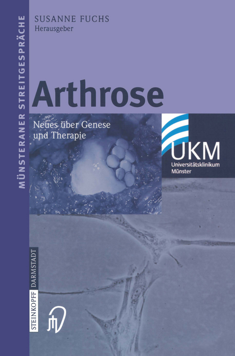 Arthrose - 