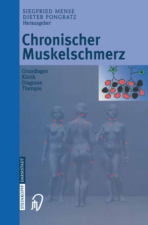 Chronischer Muskelschmerz - 