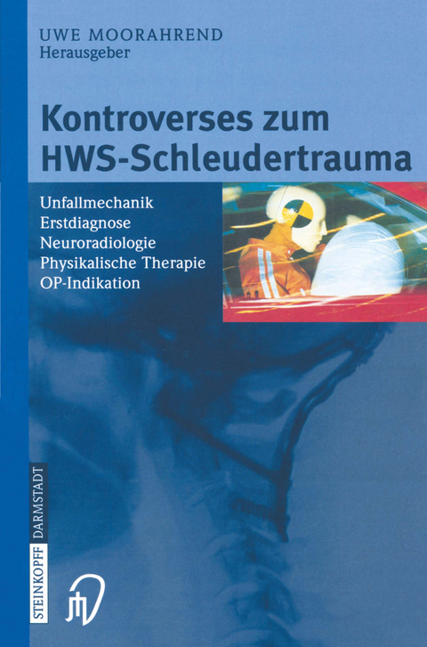 Kontroverses zum HWS-Schleudertrauma - 