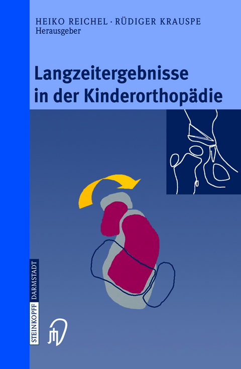 Langzeitergebnisse in der Kinderorthopädie - 