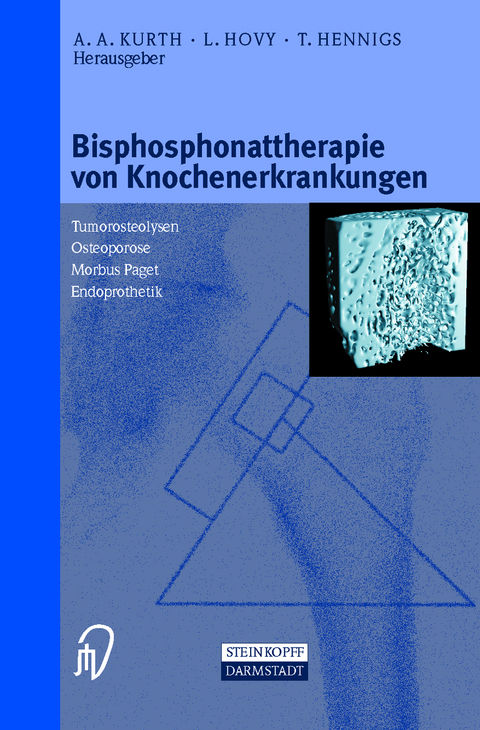 Bisphosphonattherapie von Knochenerkrankungen - 