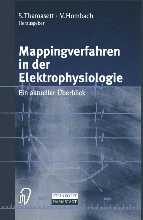 Mappingverfahren in der Elektrophysiologie - 