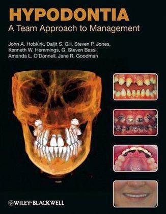 Hypodontia - John A. Hobkirk, Daljit S. Gill, Steven P. Jones, Kenneth W. Hemmings, G. Steven Bassi