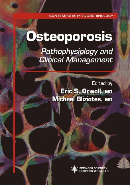 Osteoporosis - 