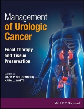 Management of Urologic Cancer - 