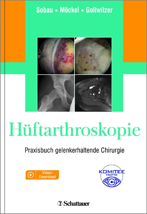 Hüftarthroskopie - 