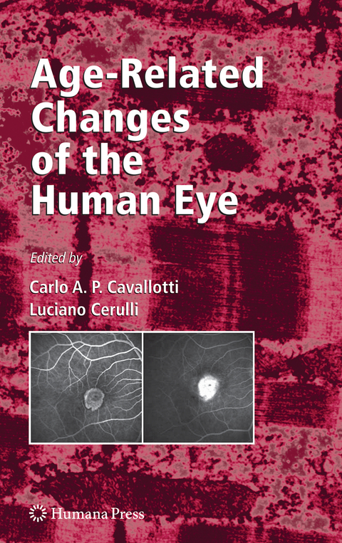 Age-Related Changes of the Human Eye - 