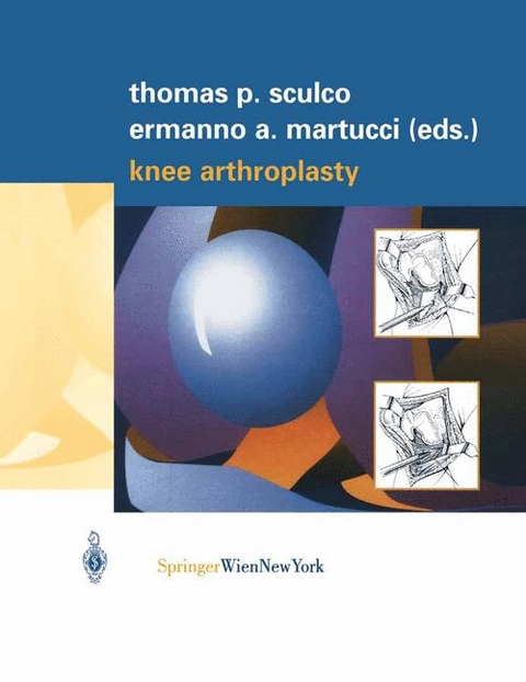 Knee Arthroplasty - 