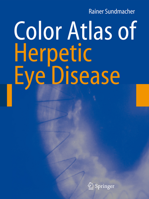 Color Atlas of Herpetic Eye Disease - Rainer Sundmacher