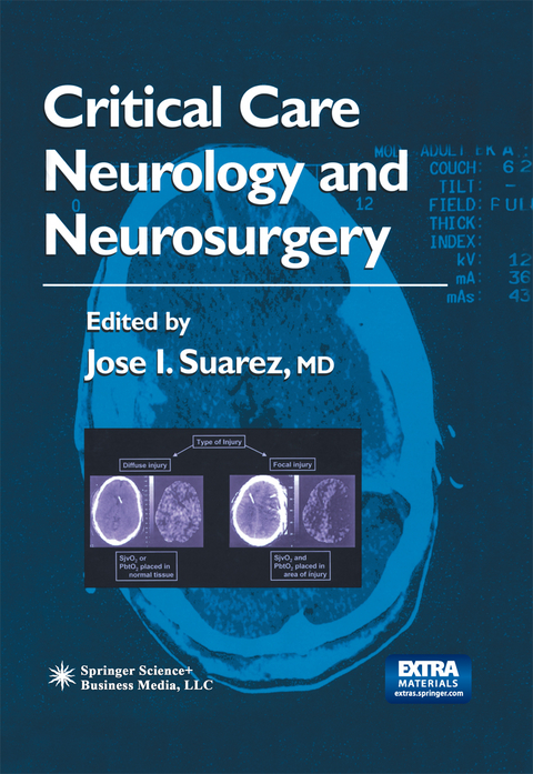 Critical Care Neurology and Neurosurgery - 