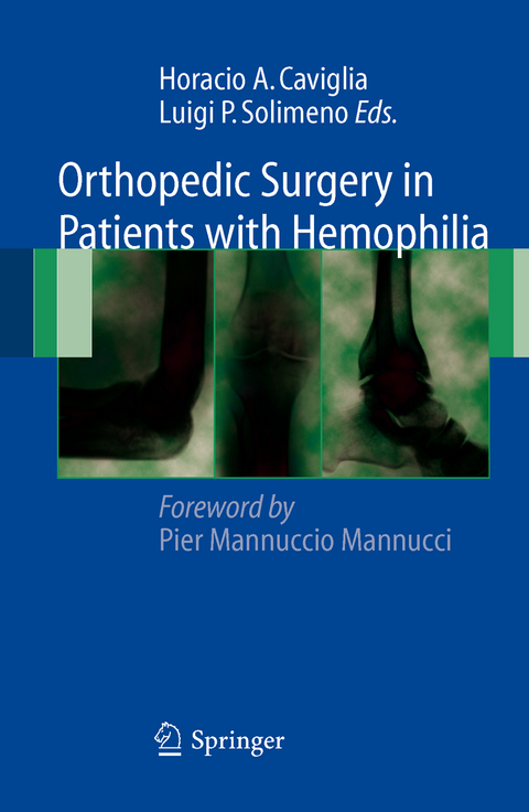 Orthopedic Surgery in Patients with Hemophilia - 