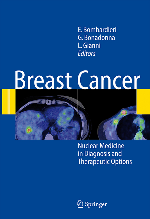 Breast Cancer - 